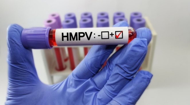 HMPV RT-PCR Test